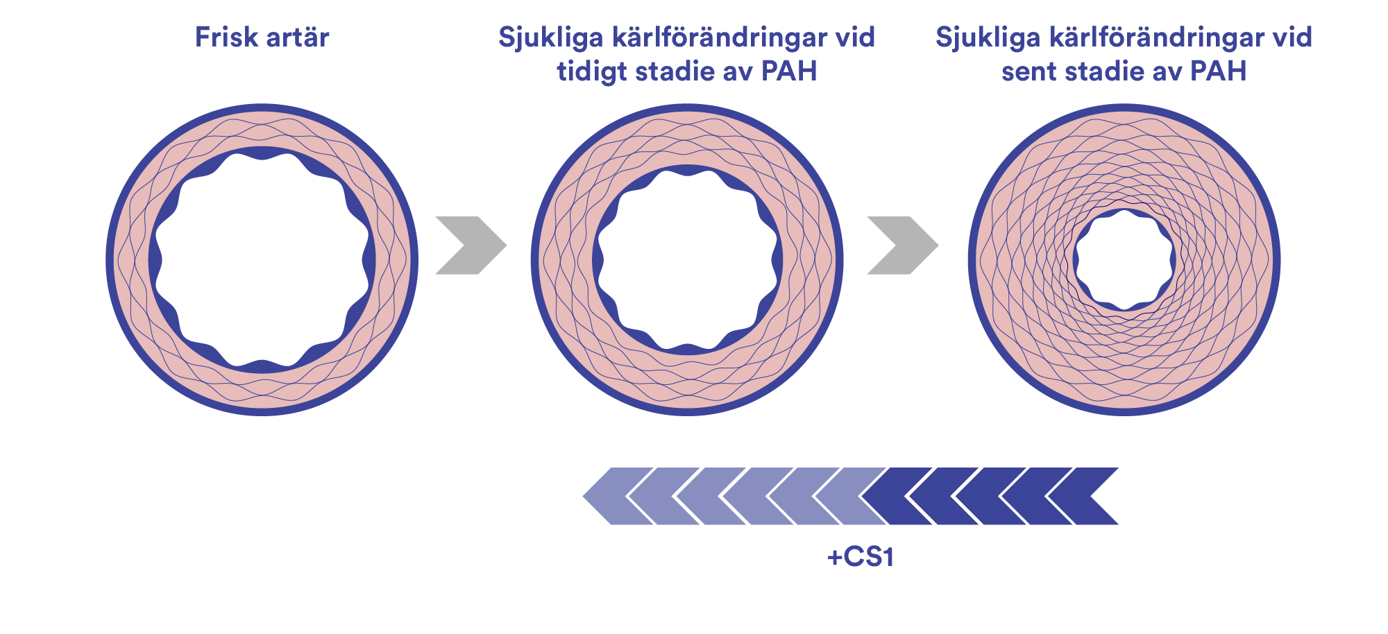 Patofysiologi för PAH
