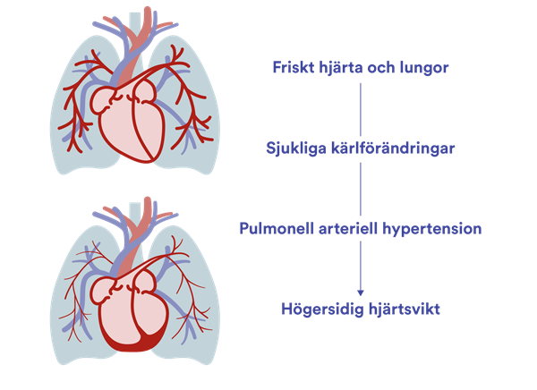 Vad händer i kroppen?
